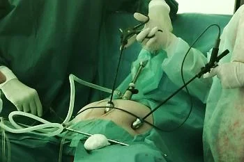 Специалисты Перинатального центра успешно проводят операции по сохранению беременности женщинам с короткой шейкой матки Специалисты Перинатального центра успешно проводят операции по сохранению беременности женщинам с короткой шейкой матки